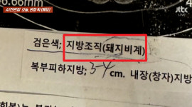 환자 검사 결과지에 돼지비계라고 적은 의사, 따지자 오지말라