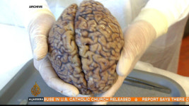 [Al jazeera] Sydney 'Brain Bank' studies athletes' head trauma