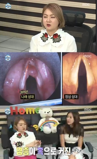 '나 혼자' 박나래, 성대에 생겨난 혹 때문에 수술 결정