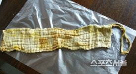 [단독] 수원 백성병원, 40대 환자에 거즈 넣은 채 맹장수술 논란