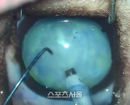 백내장 수술, 초기에 할수록 효과적 [김하국의 애니멀세대]