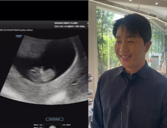 홍진호, 연말에 아빠된다..2세 태명은 ‘콩콩이’