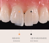 연예인도 ‘내돈내산’ 화제…새 신부 ‘하니’도 선택한 제로네이트[SS이슈]