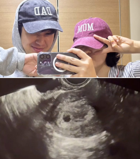 레인보우 출신 정윤혜, 임신 소식 공개 허니문 베이비와 함께하는 행복
