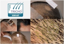 자올 닥터스오더, 독일 임상테스트서 효과 입증