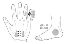 [유태우의 서금건강법] 발목 외측 삘 땐 새끼손가락 끝마디 상응점 찾아 압진봉으로 10~30분 꾹꾹 눌러야