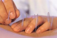 [메디스토리] “침ㆍ부항만으론 도태…한방도 엑스레이 사용하게 해주오”