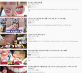 [시시콜콜] 치아에서 빛나는 보석 투스젬, 붙여도 괜찮을까