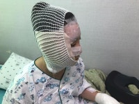 손가락 붙고, 살갗 벗겨져... 부산 목욕탕 화재 경찰관에 동료 모금 이유는