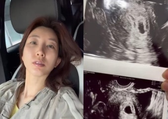 이특 누나 박인영, 유산 고백 