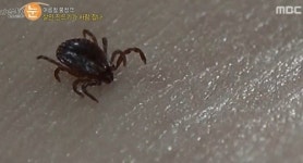 리얼스토리 눈 살인진드기 사망자, 공교롭게도 모두 고구마 밭에서? 진드기 최상 조건 주의