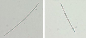 경기도 지역서 국내 미기록종 유해남조류 발견
