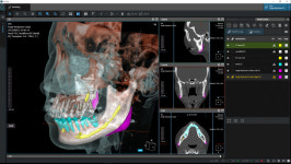 [인터뷰] 최정필 코어라인소프트 대표 의료 3D 기술로 세계 시장 공략