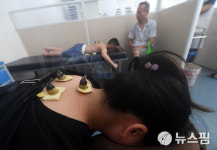 [사진] 겨울병 여름에 예방 삼복더위에 뜸 치료 받은 중국인  
