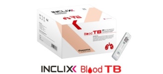 수젠텍, 웅비메디텍 통해 결핵 신속진단키트 국내 판매 개시