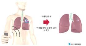 불치병 치료 후 몸속에서 스스로 녹아 사라지는 전자의료기기 개발