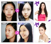 방학 동안 예뻐지는 쌍꺼풀수술 선택법