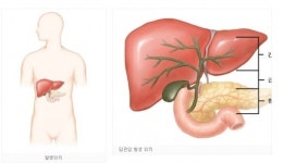 이왕표 담도암, 어떤 병이길래?…생존율 낮고 치료 어려워
