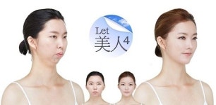 양악수술, ‘렛미인’ 16인 V라인 비결로 밝혀져