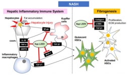 모든바이오, ‘MDB-8117’ NASH 치료제 SCI급 국제학술지 등재