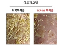 셀리버리 “자가면역질환 치료제 iCP-NI, 아토피 치료효능 입증”