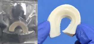 엠젠솔루션, ‘반월상 연골판’ 이식재 상용화 본격화