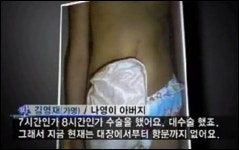 조두순사건 피해자 나영이 인공항문 이식 8시간 대수술