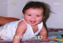 셰인 안암 사연 공개, 생후 18개월 만에 안구적출 수술