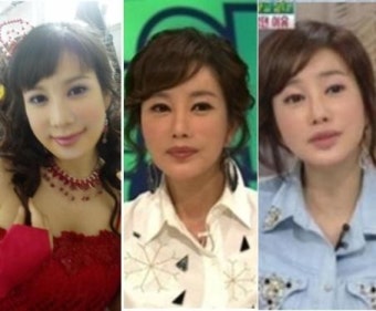 노현희 성형에 동료들도 못알아봐? 