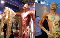 WSJ, “중국 양심수 정기적 신체검사...사실상 ‘장기 수확 농장’ 구축”