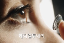 눈이 뿌옇게 각막혼탁, 알고 치료하자