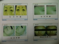 통증완화 장비로 피부·비만 치료?…메디시스 ‘셀린디온’ 판쳐