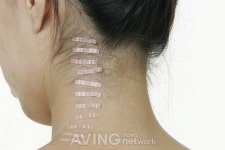 [미리보는 KIMES 2014] 생빛한의원, 인체 빛으로 치료하는 침스밴드&침스웨어 전시