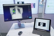 [바이오코리아 2018 영상] 루닛, X-ray 분석하는 정확도 높은 인공지능 기술 선봬
