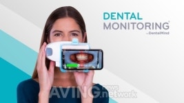 덴탈 모니터링, 포토 모니터링 라이트 솔루션 출시