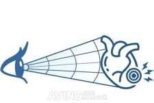[CES 2021 SEOUL] ㈜메디웨일(MediWhale), 안질환 진단 및 혈관성 질환 예측 AI 통합 솔루션 닥터눈으로 세계 시장 나아가