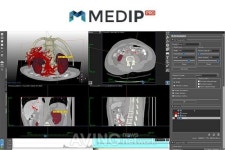 [KIMES 2021] 메디컬아이피㈜(MEDICALIP Co., Ltd.), 의료 빅데이터 가치 제고하는 AI 의료 솔루션 공개