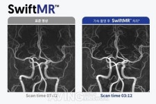 에어스메디컬, KIMES 2022서 MRI 촬영 시간 절반으로 줄이는 딥러닝 기반 영상 복원 솔루션 SwiftMR 공개