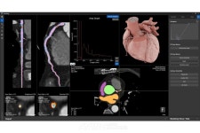 에이아이메딕, KIMES 2024서 HeartMedi+ 소개 나선다... 심뇌혈관 컴퓨터 시뮬레이션 플랫폼 사업 확장 목표