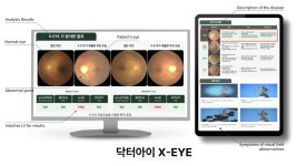 파이헬스케어, AI EXPO KOREA 2026서 디지털AI의료기기 닥터아이 공개... 안저사진 1장으로 7대 질환 예측