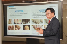 메디셀헬스케어, 손발톱 무좀 잡는 마이코시스레이저로 미국·브라질 정조준... 합병증 없이 완치하는 손발톱 무좀 레이저