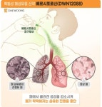 대웅제약, 폐섬유증 후보물질 ‘베르시포로신’, 유럽에서도 희귀의약품 지정