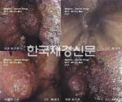군체, 개봉 직후 박스오피스 1위… 연상호 감독 신작으로 흥행 돌풍 예고, 올해 최고 오프닝 스코어 기록