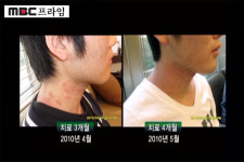 MBC 다큐 ‘프라임’에 방영된 ‘청폐차’에 화제 집중