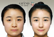 사각턱 얼굴, V라인 만드는 헤어스타일은?
