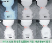 바이콘,  ‘골높이 증가 현상’  최초 공개