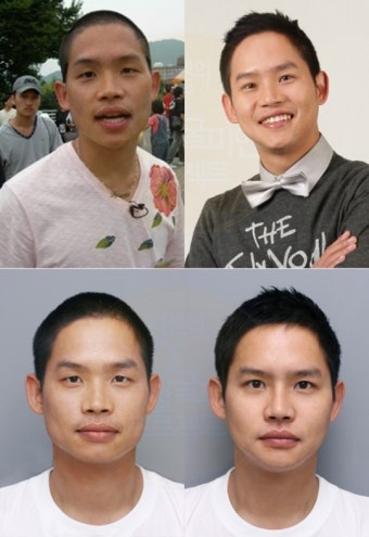 김형인, 개그맨 성형열풍 동참 ‘튜닝 후 훈남 변신’ 전후 비교했더니
