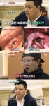 ‘님과함께2’ 윤정수 성대 검사결과 “목소리 잃을수도”
