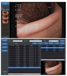 파나노믹스, Full HD 영상 출력 가능한 ‘PACS게이트웨이’ 개발