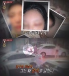 한밤중 압구정서 女 얼굴 펀치머신 때리듯 주먹 날려
